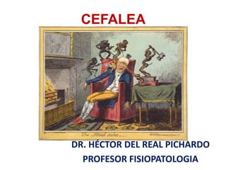 CEFALEA
DR. HÉCTOR DEL REAL PICHARDO
PROFESOR FISIOPATOLOGIA
 