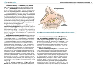 / # 3 / 2023
MPJ SEMDOR
SEMDOR
Abordaje de la cefalea postpunción dural. ¿Es posible evitarla o minimizarla? 111
Gabapentina y teofilina, o su metabolito activo (aminofi-
lina), se han utilizado para disminuir la intensidad de la cefalea
(14,39,41). La oxigenoterapia, o inhalación de oxígeno a FiO2 de
100 % a un flujo de 6-15 l/min durante 15-30 min, mediante mascari-
lla facial, ha demostrado eficacia en el tratamiento de cefaleas (42).
En casos refractarios al tratamiento conservador o cefaleas de
intensidad moderada-alta se requieren terapias intervencionistas.
Los bloqueos occipitales, el bloqueo del ganglio esfenopalatino
y los parches epidurales con distintos materiales han sido utiliza-
dos con buenos resultados, aunque la técnica más eficiente sigue
siendo el parche hemático epidural. Antes de realizar todas ellas,
es necesario informar del procedimiento y firmar el documento
de consentimiento informado específico.
Bloqueos nerviosos occipitales con anestésico local aso-
ciado, guiados con ultrasonidos han demostrado ser eficaces en
caso de cefalea intensa (EVA mayor de 5), aunque siempre asocia-
do a medidas conservadoras y, en caso de fracaso del bloqueo, se
recomienda la realización de parche hemático epidural en caso de
la técnica recomendada asocia lidocaína 2 % (2-3 ml) a dexameta-
sona (4 mg) (43,44).
Bloqueo del ganglio esfeno-palatino (BGEP) (43): la técnica
transnasal no requiere pruebas de imagen, es de fácil realización
y mínimamente invasiva (45). El bloqueo inhibe la vasodilatación
cerebral inducida por la estimulación parasimpática secundaria
a la punción meníngea. La técnica se realiza con el paciente
en decúbito supino y ligera extensión cervical. Se introducen
suavemente torundas humedecidas en 2 ml de anestésico local
(lidocaína 4 %, levobupivacaína 0,5 %, ropivacaína de 0,5 % a
1 %), a veces asociado a dexametasona (43) bilateralmente, con
un ángulo de 45° respecto al paladar duro, siguiendo el borde
superior del cornete medio, hasta alcanzar la pared posterior de
la nasofaringe (Figura 4), donde debe permanecer 15-20 min (46).
Esta técnica está contraindicada en fracturas de base de cráneo,
infecciones locales/sistémicas. La duración media del efecto anal-
gésico continúa mal definida y en el ensayo clínico de Jespersen
no se encontraron diferencias significativas entre la utilización de
anestésico local o suero fisiológico 30 minutos después de realizar
la técnica (46).
El parche epidural con pegamento biológico de fibrina
(3-10 ml) se ha utilizado de forma preventiva (47) y terapéuti-
ca, sin resultados demasiado esperanzadores. Parche epidural
(PE), con cristaloides y coloides presenta efecto pasajero. El
parche de plasma autólogo rico en plaquetas (PRP) consiste en
administrar 10-20 ml de PRP autólogo (4-6 ml de plasma y 6-12 ml
de suero) en pacientes donde ha fracasado el parche hemático.
Todas estas técnicas se asocian a complicaciones como infeccio-
nes virales, reacciones autoinmunes y anafilácticas, además del
riesgo de una nueva punción.
El parche hemático epidural (PHE) es el tratamiento de elec-
ción en cefalea persistente tras tratamiento conservador más de
24-48 horas (19). También se aplica en el momento de realizar la
punción dural, como medida preventiva del cuadro de CPPD (48).
Clásicamente, la tasa de éxito del parche hemático epidural es de
un 85 % con el primer intento (49). La técnica ideal se realiza por
dos anestesiólogos: uno localiza el espacio epidural un espacio
por debajo lugar de la punción mientras el otro extrae sangre de
una vena del antebrazo del paciente para entregársela al primer
anestesiólogo para que la inyecte por vía epidural, de forma lenta
y manteniendo comunicación con el paciente. Es conveniente ex-
Figura 4. Esquema anatómico de la técnica de bloqueo del ganglio esfenopalatino.
 