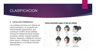 Comprehensive Overview of Headache Types, Causes, and Treatments | PPTX