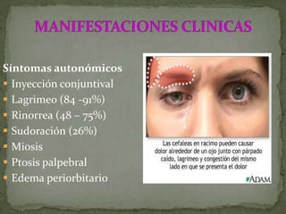 4. AINES y otras combinaciones analgésicas(de primera línea en migrañas leves a moderadas) Ketorolaco