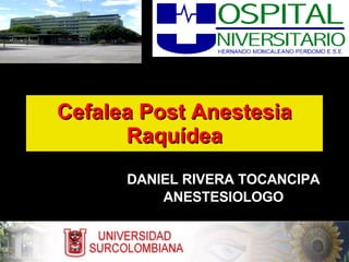 Cefalea Post Anestesia Raquídea DANIEL RIVERA TOCANCIPA ANESTESIOLOGO 