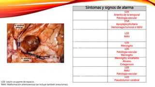 Síntomas y signos de alarma 
Cefalea de aparición en 
mayores de 50 años 
LOE 
Arteritis de la temporal 
Patología vascular 
Cefalea de inicio explosivo 
HSA 
Apoplejia pituitaria 
Hemorragia tumoral o MAV 
Cefalea desencadenada por 
esfuerzo físico, cambios 
posturales o Valsalva 
LOE 
MAV 
Cefalea progresiva de reciente 
aparición 
LOE 
Meningitis 
Cambio en el patrón de 
presentación de una cefalea 
previa 
LOE 
Patología vascular 
Meningitis 
Cefalea asociada a fiebre 
Meningitis, encefalitis 
Abceso 
Colagenosis 
Cefalea asociada a síntomas o 
signos focales (excepto el 
aura) 
LOE 
MAV 
Patología vascular 
Cefalea asociada a 
papiledema 
LOE 
Pseudotumor cerebral 
LOE: Lesión ocupante de espacio. 
MAV: Malformación arteriovenosa (se incluye también aneurismas). 
 