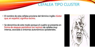 CEFALEA TIPO CLUSTER 
• El nombre de esta cefalea proviene del término inglés clúster 
que, en español, significa racimo. 
• Se denomina de este modo porque el cuadro se presenta en 
forma de ataques periódicos (en racimo) de cefalea muy 
intensa, asociada a síntomas autonómicos ipsilaterales. 
 