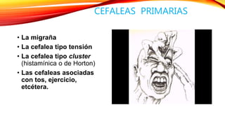 CEFALEAS PRIMARIAS 
• La migraña 
• La cefalea tipo tensión 
• La cefalea tipo cluster 
(histamínica o de Horton) 
• Las cefaleas asociadas 
con tos, ejercicio, 
etcétera. 
 