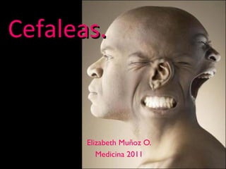 Cefaleas.



       Elizabeth Muñoz O.
          Medicina 2011
 