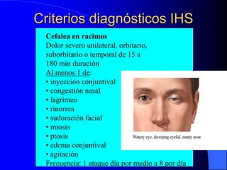 Criterios diagnósticos IHS
Cefalea en racimos
Dolor severo unilateral, orbitario,
suborbitario o temporal de 15 a
180 min duración
Al menos 1 de:
• inyección conjuntival
• congestión nasal
• lagrimeo
• rinorrea
• sudoración facial
• miosis
• ptosis
• edema conjuntival
• agitación
Frecuencia: 1 ataque día por medio a 8 por día
 