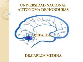 UNIVERSIDAD NACIONAL
AUTONOMA DE HONDURAS
CEFALEAS
DR.CARLOS MEDINA
 