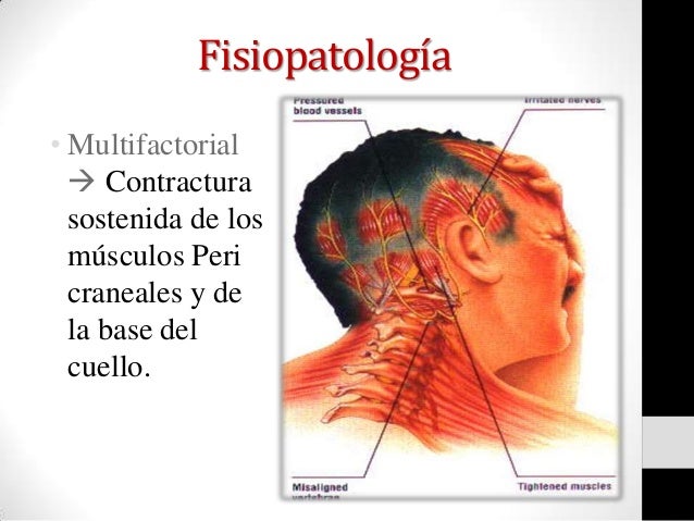 Duele el músculo del cuello hasta el hombro después del sueño