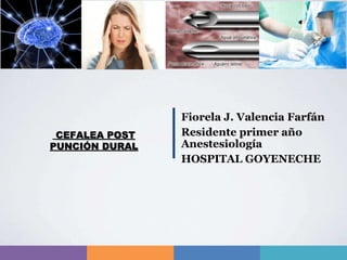 CEFALEA POST
PUNCIÓN DURAL
Fiorela J. Valencia Farfán
Residente primer año
Anestesiología
HOSPITAL GOYENECHE
 