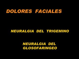 DOLORES  FACIALES NEURALGIA  DEL  TRIGEMINO NEURALGIA  DEL  GLOSOFARINGEO 