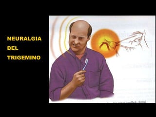 NEURALGIA  DEL  TRIGEMINO 
