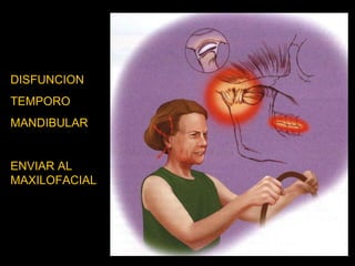 DISFUNCION  TEMPORO MANDIBULAR ENVIAR AL MAXILOFACIAL 