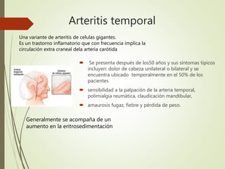 Arteritis temporal
 Se presenta después de los50 años y sus síntomas típicos
incluyen: dolor de cabeza unilateral o bilateral y se
encuentra ubicado temporalmente en el 50% de los
pacientes
 sensibilidad a la palpación de la arteria temporal,
polimialgia reumática, claudicación mandibular,
 amaurosis fugaz, fiebre y pérdida de peso.
Una variante de arteritis de celulas gigantes.
Es un trastorno inflamatorio que con frecuencia implica la
circulación extra craneal dela arteria carótida
Generalmente se acompaña de un
aumento en la eritrosedimentación
 