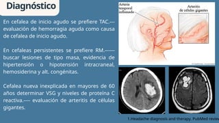 Comprehensive Overview of Primary Headaches: Types, Diagnosis, and ...
