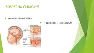 SOSPECHA CLINICA???


MENINGITIS LINFOCITARIA


 INGRESO EN INFECCIOSAS

 