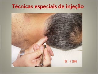 Técnicas especiais de injeção 