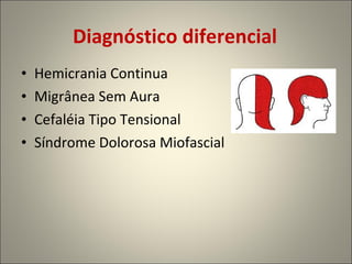 Diagnóstico diferencial Hemicrania Continua  Migrânea Sem Aura Cefaléia Tipo Tensional Síndrome Dolorosa Miofascial 