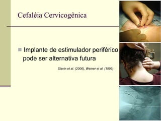 Cefaléia Cervicogênica Implante de estimulador periférico pode ser alternativa futura    Slavin et al. (2006), Weiner et al. (1999) 