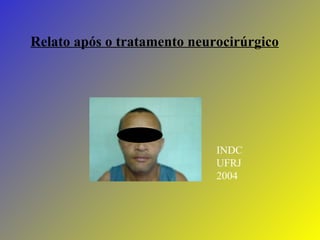 Relato após o tratamento neurocirúrgico INDC UFRJ 2004 