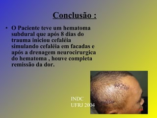 Conclusão : O Paciente teve um hematoma subdural que após 8 dias do trauma iniciou cefaléia simulando cefaléia em facadas e após a drenagem neurocirurgica do hematoma , houve completa remissão da dor.  INDC UFRJ 2004 