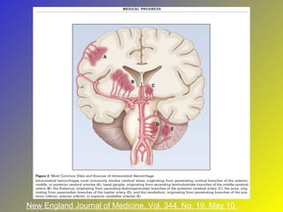 New England Journal of Medicine, Vol. 344, No. 19, May 10, 2001 