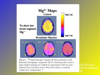 NEUROLOGY 2003;61(suppl4)82-88 