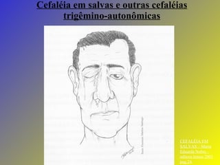 Cefaléia em salvas e outras cefaléias trigêmino-autonômicas CEFALÉIA EM SALVAS – Maria Eduarda Nobre – editora lemos 2001 pag.24. 