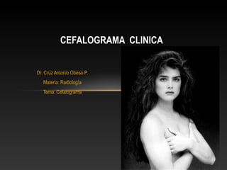 CEFALOGRAMA CLINICA


Dr. Cruz Antonio Obeso P.
   Materia: Radiología
   Tema: Cefalograma
 