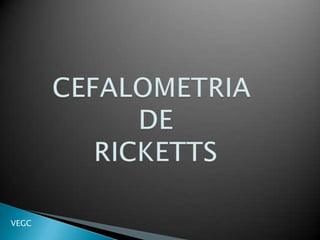 CEFALOMETRIA DE RICKETTS VEGC 