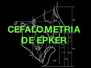 CEFALOMETRIA DE EPKER 