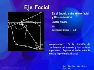 CEFALOMETRIA DE RICKETTS, LATERAL | PPT