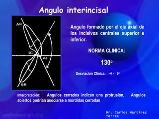 Angulo interincisal Angulo formado por el eje axial de los incisivos centrales superior e inferior. NORMA CLINICA: 130 o D...