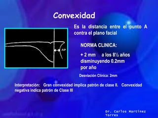 Convexidad Es la distancia entre el punto A contra el plano facial NORMA CLINICA: + 2 mm  a los 8½ años disminuyendo 0.2mm...