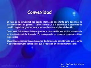 Convexidad El valor de la convexidad nos aporta información importante para determinar la clase esquelética en general.  D...