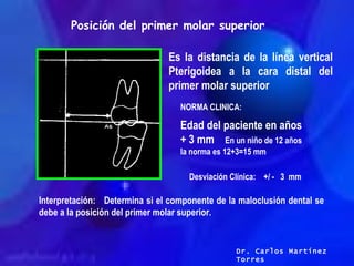 Posición del primer molar superior Es la distancia de la línea vertical Pterigoidea a la cara distal del primer molar supe...