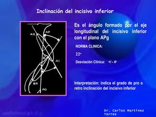 Inclinación del incisivo inferior Es el ángulo formado por el eje longitudinal del incisivo inferior con el plano APg NORM...