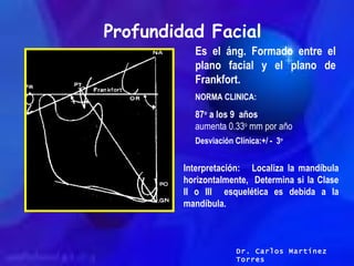 Profundidad Facial Es el áng. Formado entre el plano facial y el plano de Frankfort.  NORMA CLINICA: 87 o  a los 9  años  ...