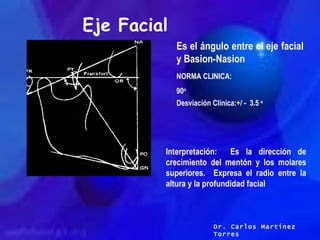 Eje Facial Es el ángulo entre el eje facial y Basion-Nasion NORMA CLINICA: 90 o Desviación Clínica:+/ -  3.5  o Interpreta...