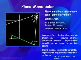 Plano Mandibular Plano mandibular relacionado con el plano de Frankfort NORMA CLINICA: 26 o  a la edad de  9  años.  Dismi...