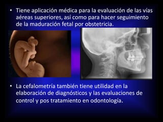• Tiene aplicación médica para la evaluación de las vías
aéreas superiores, así como para hacer seguimiento
de la maduración fetal por obstetricia.
• La cefalometría también tiene utilidad en la
elaboración de diagnósticos y las evaluaciones de
control y pos tratamiento en odontología.
 