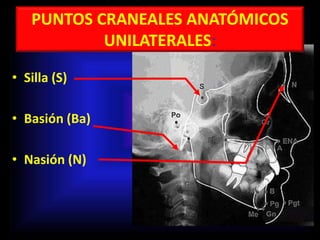 PUNTOS CRANEALES ANATÓMICOS
UNILATERALES:
• Silla (S)
• Basión (Ba)
• Nasión (N)
 