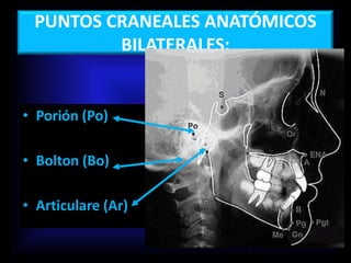 PUNTOS CRANEALES ANATÓMICOS
BILATERALES:
• Porión (Po)
• Bolton (Bo)
• Articulare (Ar)
 