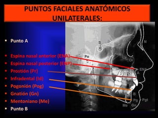 PUNTOS FACIALES ANATÓMICOS
UNILATERALES:
 Punto A
 Espina nasal anterior (ENA)
 Espina nasal posterior (ENP)
 Prostión (Pr)
 Infradental (Id)
 Pogonión (Pog)
 Gnatión (Gn)
 Mentoniano (Me)
 Punto B
 