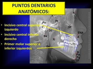 PUNTOS DENTARIOS
ANATÓMICOS:
• Incisivo central superior
izquierdo
• Incisivo central inferior
derecho
• Primer molar superior e
inferior izquierdos
 