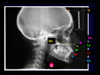 c
ISL
Li
Ls
Pn
Sn
Tr
 