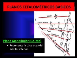 PLANOS CEFALOMÉTRICOS BÁSICOS
Plano Mandibular (Go-Me)
 Representa la base ósea del
maxilar inferior.
 