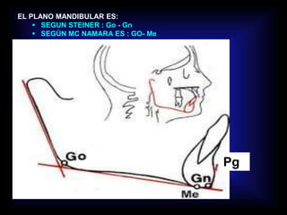 Pg
EL PLANO MANDIBULAR ES:
 SEGUN STEINER : Go - Gn
 SEGÚN MC NAMARA ES : GO- Me
 
