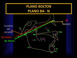 PLANO BOLTON
PLANO BA- N
Condilos
del
occipital
N:
Nasion
Bo: Bolton
Ba: Basion
 