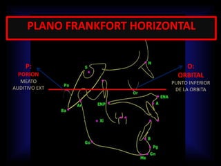 PLANO FRANKFORT HORIZONTAL
P:
PORION
MEATO
AUDITIVO EXT
O:
ORBITAL
PUNTO INFERIOR
DE LA ORBITA
 