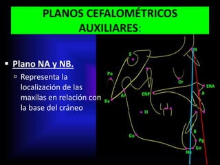 PLANOS CEFALOMÉTRICOS
AUXILIARES:
 Plano NA y NB.
 Representa la
localización de las
maxilas en relación con
la base del cráneo
 